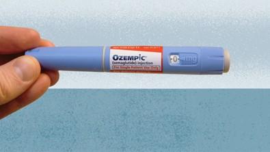 Can Using Ozempic for Weight Loss Lead to Hair Loss